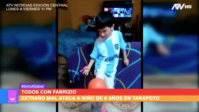  Extraño mal ataca a niño de 8 años en Tarapoto